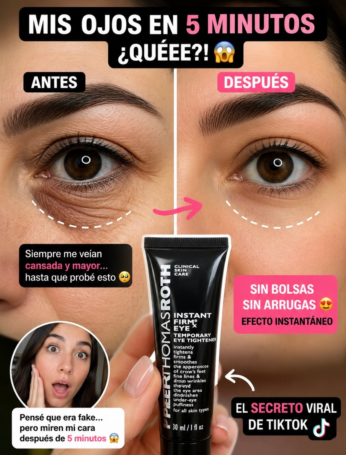 Pether thomas™ - Elimina las arrugas y ojeras al instante🫧
